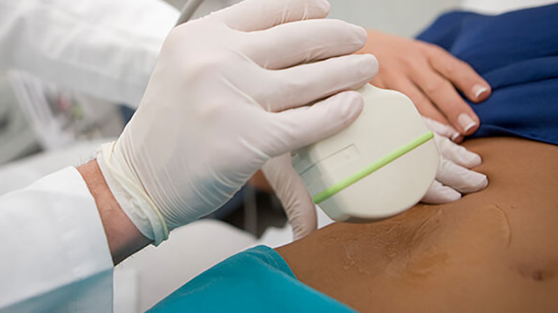 Endoscopic Procedures Endoscopic Procedures